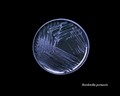 bordetella pertussis
